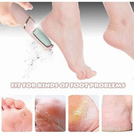 Electric Foot Callus Remover Rechargeable Pedicure