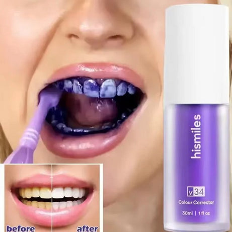 HiSmile Serum for Teeth Whitening